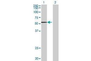 Lane 1: CABC1 transfected lysate ( 71. (CABC1 293T Cell Transient Overexpression Lysate(Denatured))