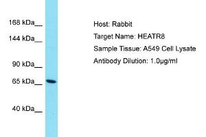 Host: Rabbit Target Name: HEATR8 Sample Type: A549 Whole Cell lysates Antibody Dilution: 1. (HEATR8 抗体  (N-Term))