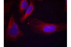 Immunofluorescence staining of methanol-fixed Hela cells using c-Cbl(phospho-Tyr700) Antibody. (CBL 抗体  (pTyr770))