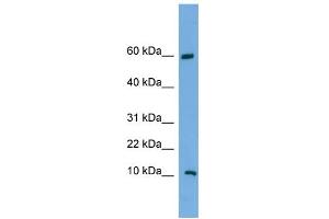 WB Suggested Anti-C20orf144 Antibody Titration: 0. (C20orf144 抗体  (Middle Region))