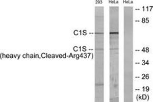 Western Blotting (WB) image for anti-Complement Component 1, S Subcomponent (C1S) (AA 388-437), (Cleaved-Arg437) antibody (ABIN2891190) (C1S 抗体  (Cleaved-Arg437))