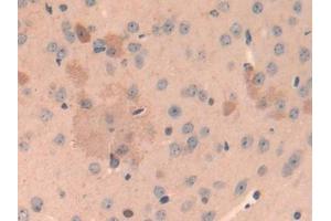 DAB staining on IHC-P; Samples: Mouse Cerebrum Tissue (Cathepsin L 抗体  (AA 18-113))