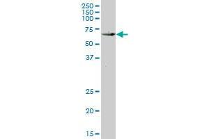 KLF10 monoclonal antibody (M14), clone 2E7. (KLF10/TIEG1 抗体  (AA 111-210))