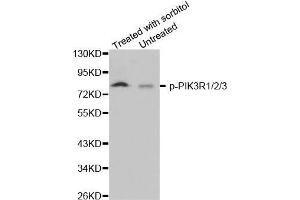 Western blot analysis of extracts from 293 cells, using phospho-PIK3R1/2/3-Y467 antibody (PIK3R1 + PIK3R2 + PIK3R3 (pTyr467) 抗体)