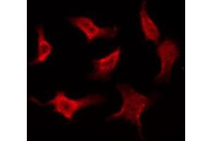 ABIN6268815 staining Hela by IF/ICC. (Caspase 8 抗体  (Cleaved-Asp384))