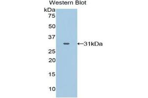 Western blot analysis of the recombinant protein. (GRAP2 抗体  (AA 15-247))