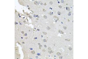 Immunohistochemistry of paraffin-embedded mouse brain using PKN1 antibody (ABIN6003498) at dilution of 1/100 (40x lens). (PKN1 抗体)