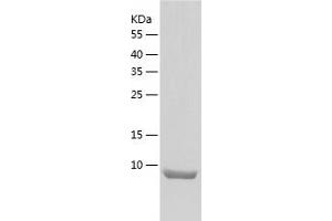 CCL6 Protein (AA 22-115) (His tag)