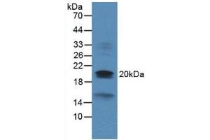 Figure. (Dual Specificity Phosphatase 3 (DUSP3) (AA 2-185) 抗体)