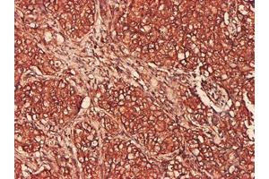 Immunohistochemistry (Formalin-fixed Paraffin-embedded Sections) (IHC (fp)) image for anti-Proteasome Subunit alpha  7 (PSMA7) (AA 1-248) antibody (ABIN562474)