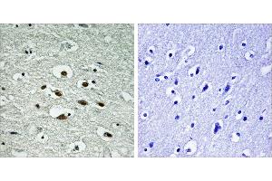 Immunohistochemistry analysis of paraffin-embedded human brain tissue using Chk1 (Phospho-Ser296) antibody. (CHEK1 抗体  (pSer296))