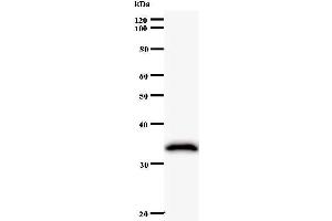 Western Blotting (WB) image for anti-ATP-Dependent RNA Helicase A (DHX9) antibody (ABIN932191) (DHX9 抗体)