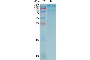 Human LGBP Protein, Flag Tag on SDS-PAGE under reducing condition. (LGALS3BP Protein (AA 1-585) (DYKDDDDK Tag))