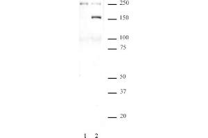 SMC1 phospho Ser957 pAb tested by Western blot. (SMC1A 抗体  (pSer957))