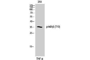 Western Blotting (WB) image for anti-NF-kappa-B inhibitor beta (NFKBIB) (pThr19) antibody (ABIN3173002) (NFKBIB 抗体  (pThr19))