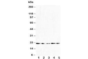 Western blot testing of FGF10 antibody and Lane 1:  U87 (FGF10 抗体  (N-Term))