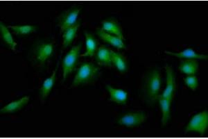 Immunofluorescence staining of Hela cells with ABIN7165702 at 1:133, counter-stained with DAPI. (PKC delta 抗体  (AA 505-633))