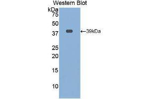 Western blot analysis of the recombinant protein. (Osteocalcin 抗体  (AA 21-99))