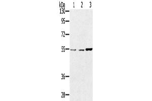 Western Blotting (WB) image for anti-Sestrin 2 (SESN2) antibody (ABIN2433786) (Sestrin 2 抗体)