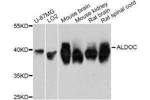 Western blot analysis of extracts of various cell lines, using ALDOC Antibody. (ALDOC 抗体)