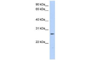 MTHFS antibody used at 1 ug/ml to detect target protein. (MTHFS 抗体)