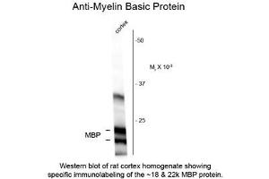 Image no. 1 for anti-Myelin Basic Protein (MBP) antibody (ABIN956786) (MBP 抗体)