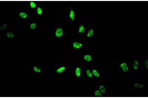 Immunofluorescent analysis of Hela cells treated by NaB using ABIN7139158 at dilution of 1:100 and Alexa Fluor 488-congugated AffiniPure Goat Anti-Rabbit IgG(H+L) (HIST1H3A 抗体  (acLys14))