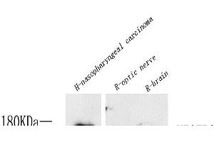 Western Blot analysis of various samples using FLK1 Polyclonal Antibody at dilution of 1:800. (VEGFR2/CD309 抗体)