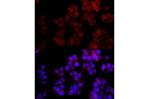 Immunofluorescence analysis of HepG2 cells using NUDT5 Rabbit mAb (ABIN7269071) at dilution of 1:100 (40x lens). (NUDT5 抗体)