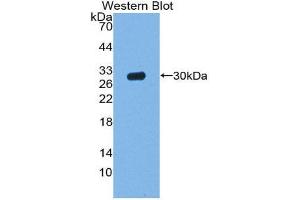 Western Blotting (WB) image for anti-Acid Phosphatase 5, Tartrate Resistant (ACP5) (AA 28-286) antibody (ABIN1857872) (ACP5 抗体  (AA 28-286))