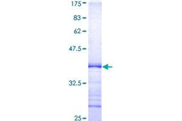 ITGB3BP Protein (AA 1-100) (GST tag)