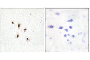 Immunohistochemistry (IHC) image for anti-Mevalonate Kinase (MVK) (Internal Region) antibody (ABIN1849535) (MVK 抗体  (Internal Region))