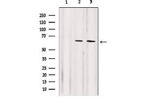 Western Blotting (WB) image for anti-Nuclear Factor-kB p65 (NFkBP65) antibody (ABIN6263616)