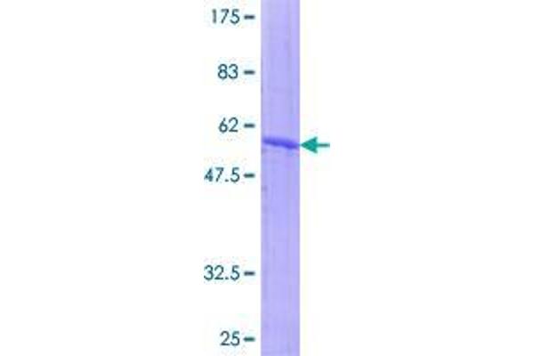 ASB7 Protein (GST tag)