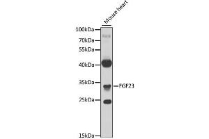 Western blot analysis of extracts of mouse heart, using FGF23 antibody. (FGF23 抗体)