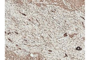 Immunohistochemistry analysis using Rabbit Anti-LRP1 Polyclonal Antibody (ABIN5696062). (LRP1 抗体  (AA 160-260) (PE))