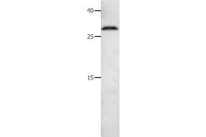 Western Blot analysis of 231 cell using MMP7 Polyclonal Antibody at dilution of 1:600 (MMP7 抗体)