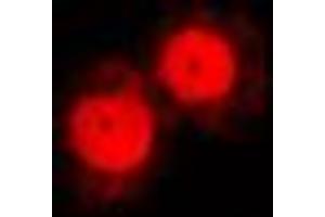 Immunofluorescent analysis of Annexin A1 staining in NIH3T3 cells. (Annexin a1 抗体  (Center))