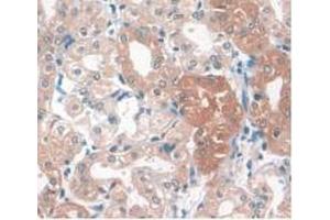 IHC-P analysis of Human Kidney Tissue, with DAB staining. (APOA1 抗体  (AA 122-267))