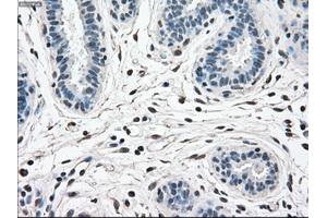 Immunohistochemical staining of paraffin-embedded breast tissue using anti-MAPK1 mouse monoclonal antibody. (ERK2 抗体)