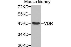 Western blot analysis of extracts of mouse kidney, using VDR antibody. (Vitamin D Receptor 抗体)