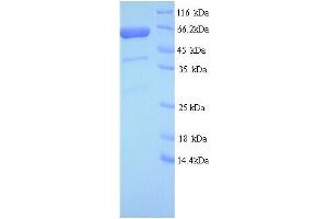 SDS-PAGE (SDS) image for GRB10 Interacting GYF Protein 2 (GIGYF2) (AA 510-1030), (partial) protein (His tag) (ABIN5714390) (GIGYF2 Protein (AA 510-1030, partial) (His tag))