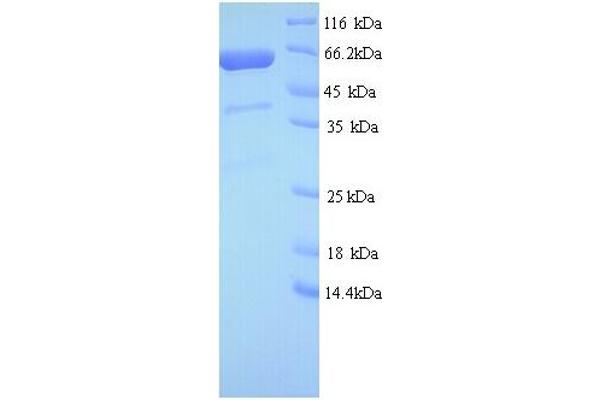 GIGYF2 Protein (AA 510-1030, partial) (His tag)