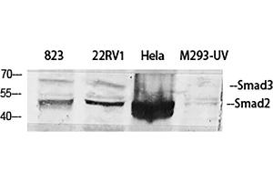 Western Blot analysis of 823 (1), 22RV1 (2), Hela (3), M293-UV (4), diluted at 1:500. (Smad2/3 抗体)