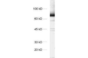 dilution: 1 : 1000, sample: rat brain homogenate (STXBP1 抗体)