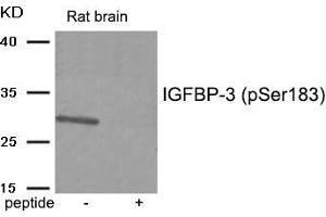 Western blot analysis of extracts from Rat brain tissue using IGFBP-3 (Phospho-Ser183) antibody. (IGFBP3 抗体  (pSer183))