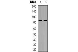 Western blot analysis of FRS2 expression in MCF7 (A), Hela (B) whole cell lysates. (FRS2 抗体)