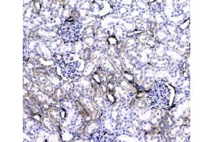 IHC testing of FFPE rat kidney tissue with CD44 antibody at 1ug/ml. (CD44 抗体)