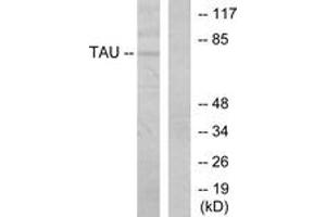 Western blot analysis of extracts from MDA-MB-435 cells, using Tau (Ab-205) Antibody. (tau 抗体  (AA 491-540))