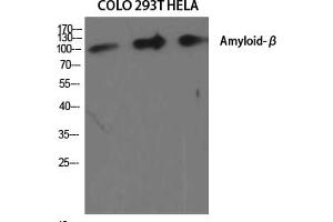 Western Blot analysis of various cells using Amyloid-β Polyclonal Antibody diluted at 1:2000. (beta Amyloid 抗体)